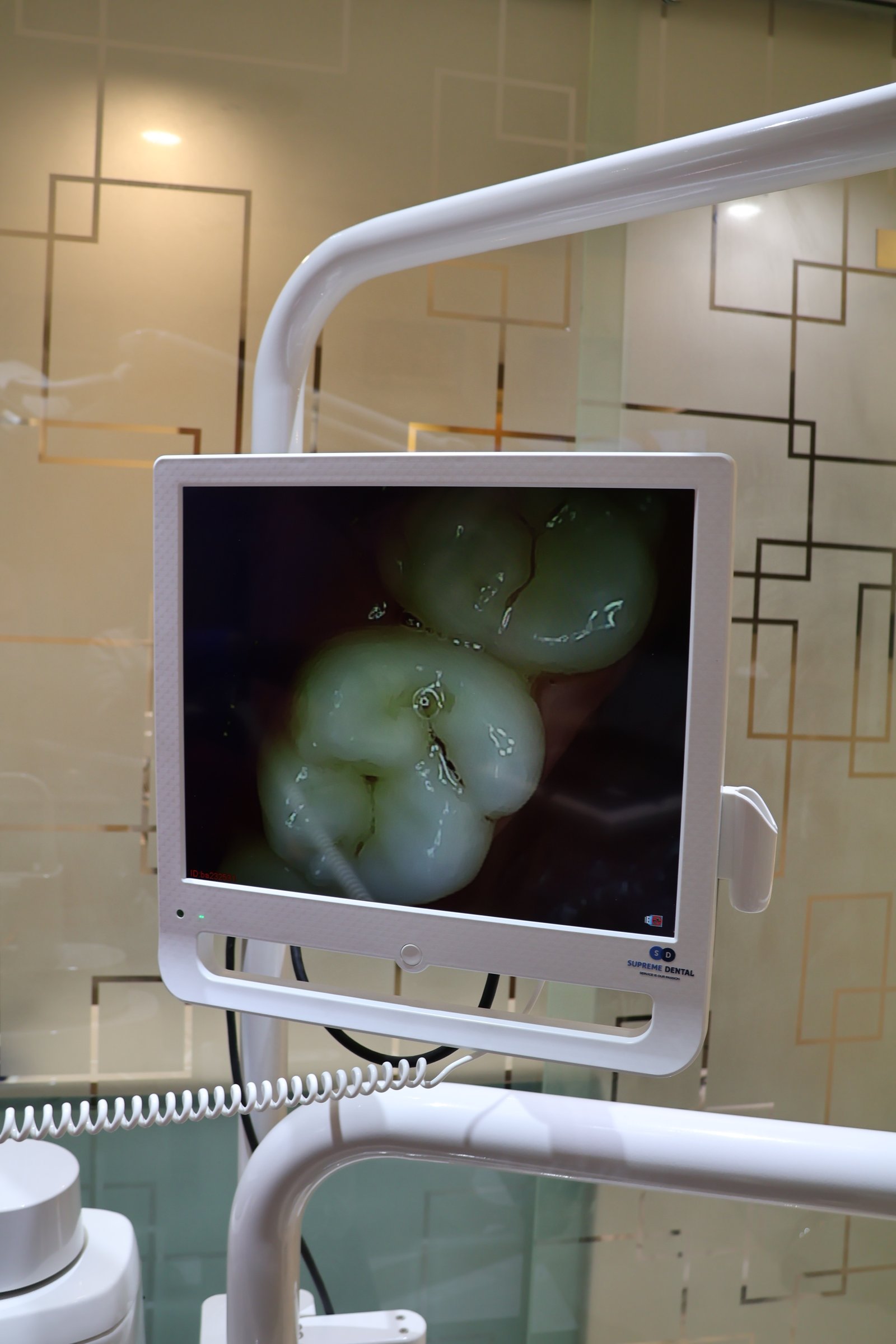 Intra-oral Camera